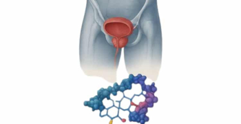 prostat1